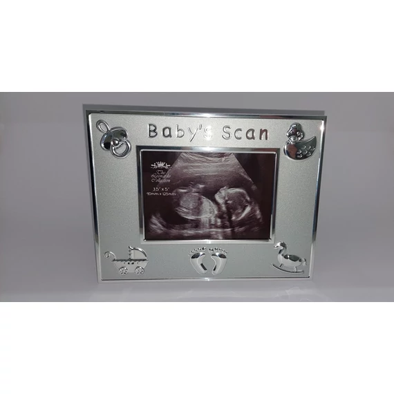 Baby's scan fém fotókeret